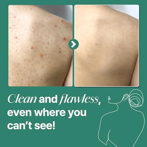 CeraVe Gel Moussant Anti-Imperfections