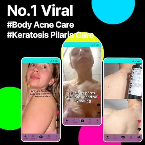 CeraVe Gel Moussant Anti-Imperfections — vue 2